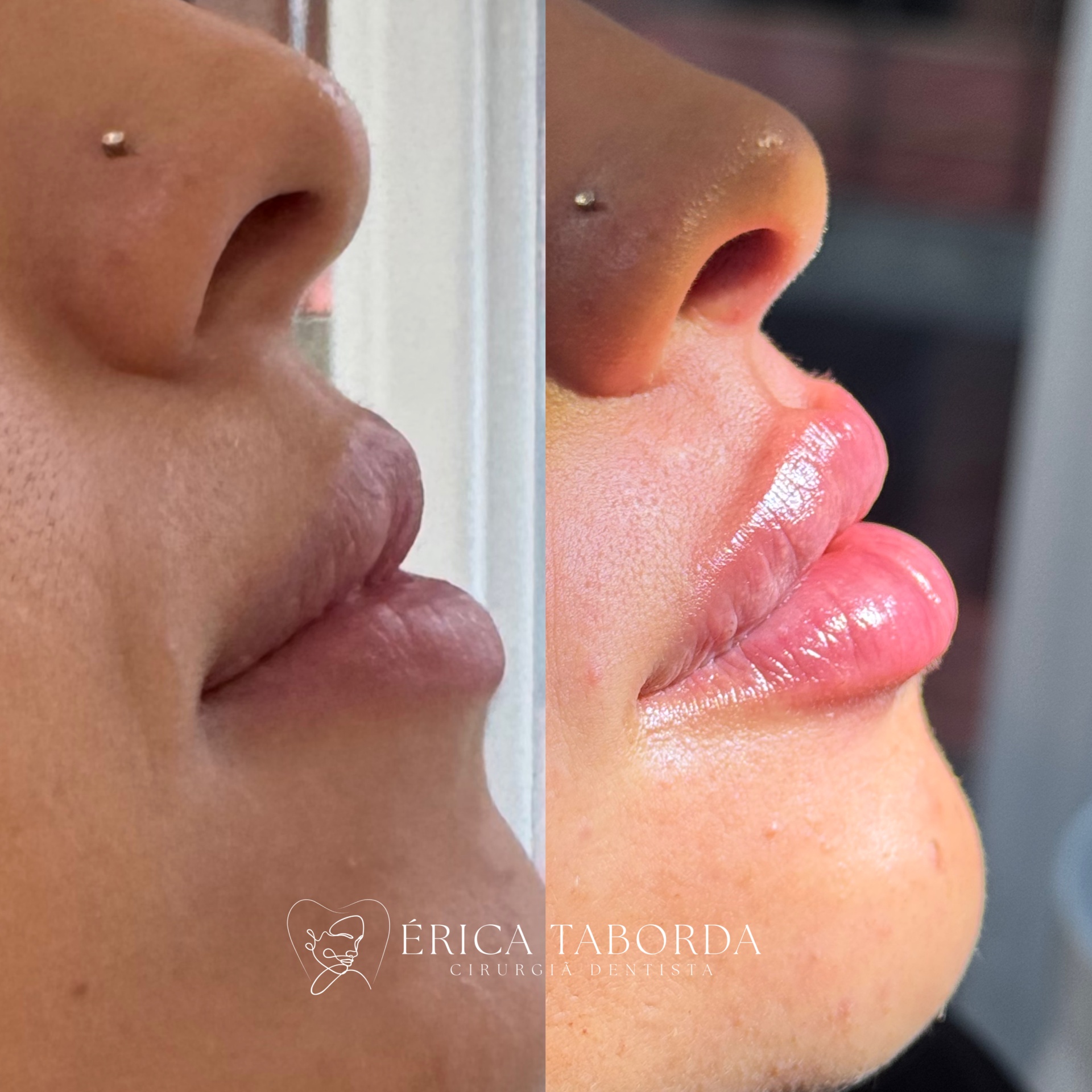 Volume e contorno naturais